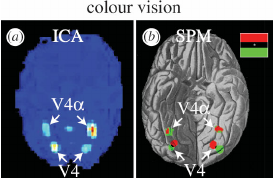 The colour-processing V4 complex in the human brain